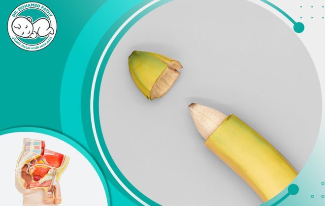 عملية ختان الذكور
