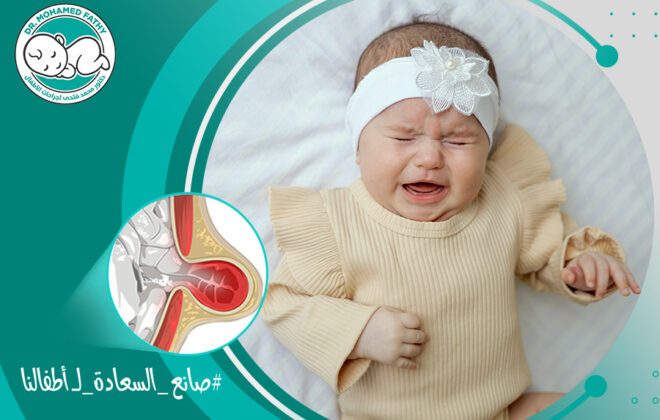 أعراض الفتق عند الأطفال البنات