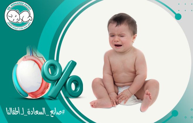 نسبة نجاح عملية القيلة المائية فى الأطفال