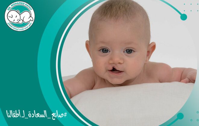 ما هي الشفة الأرنبية